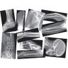 xray set for kids